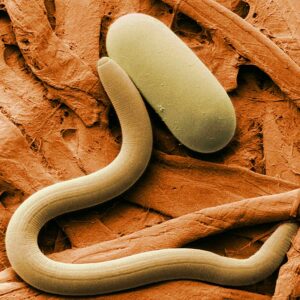 Soybean cyst nematode and egg